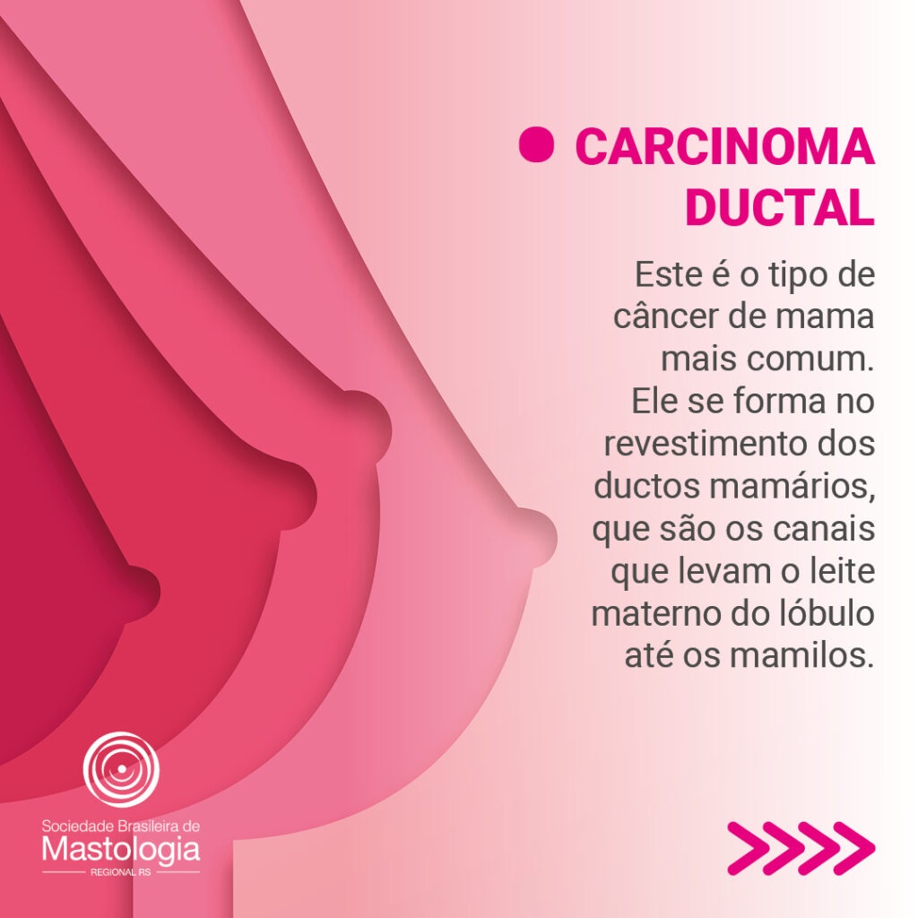 Card-pergunte-ao-mastologista-tipos-de-cancer-de-mama-2