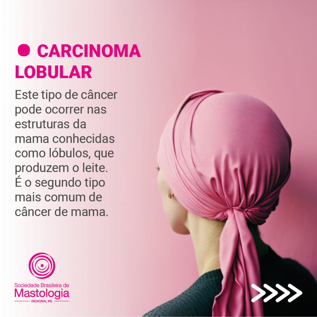 Card-pergunte-ao-mastologista-tipos-de-cancer-de-mama-3