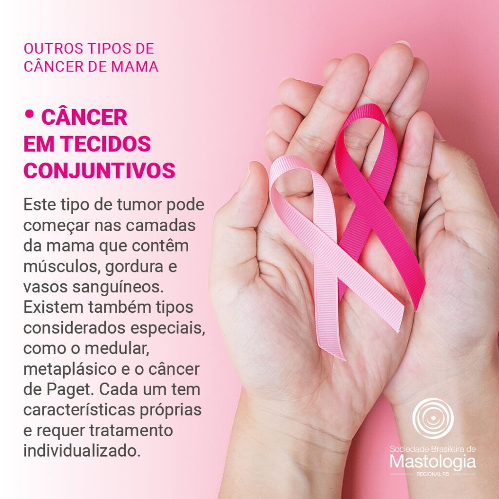 Card-pergunte-ao-mastologista-tipos-de-cancer-de-mama-4